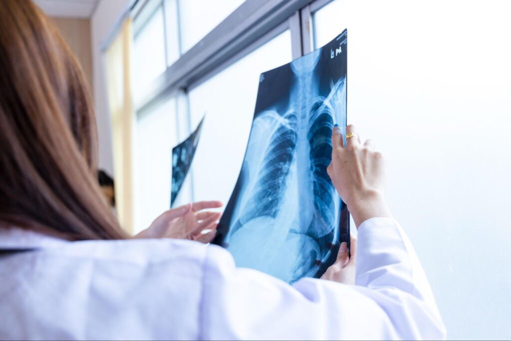 Female doctor holding up an x-ray.