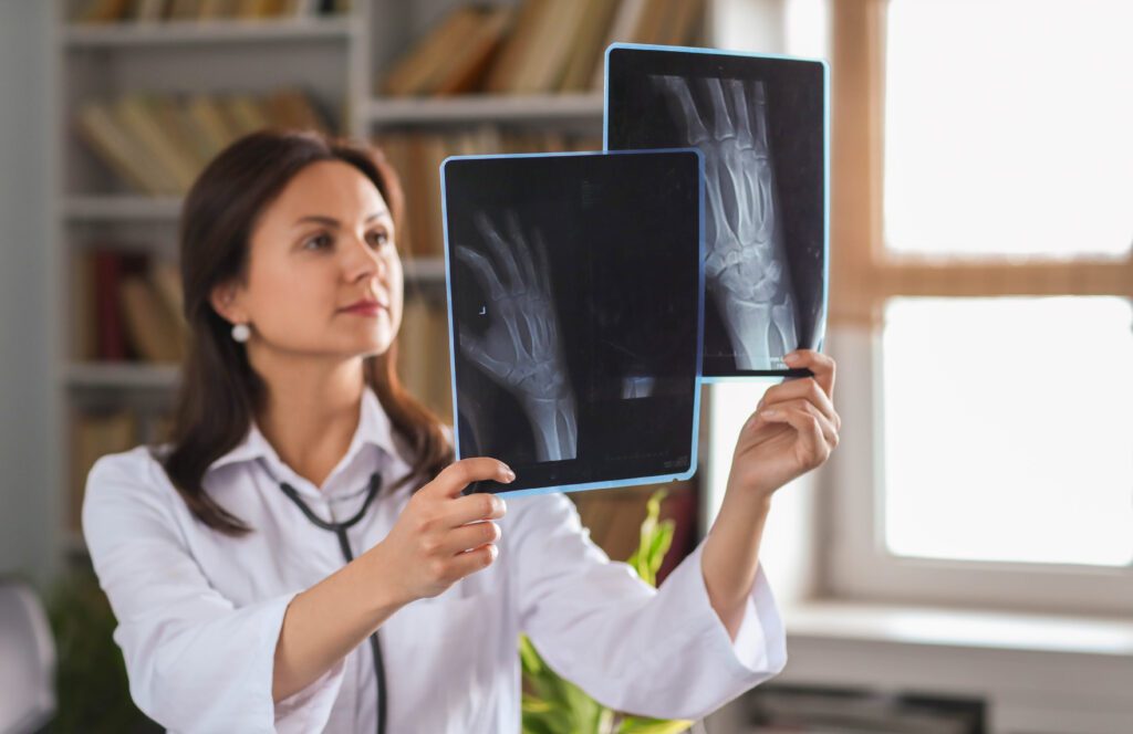 A doctor holding up two separate x-rays of someone’s hand.