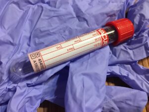 test tube, download, lab, test, diagnostics, diagnostician, medical, hospital, diagnosis, tests, glove, needle, syringe, set, closed system, blood cell-1761832.jpg